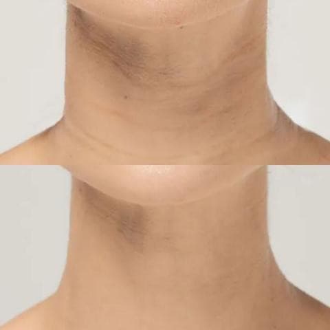 Reusable anti-wrinkle patches - 16 pieces