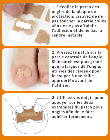 Patchs Correcteurs d'Ongles Incarnés