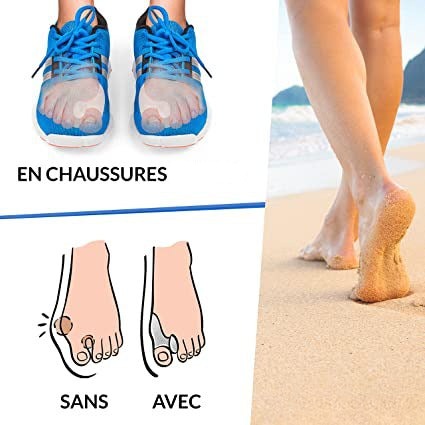 Paire de Correcteur Hallux Valgus en Silicone