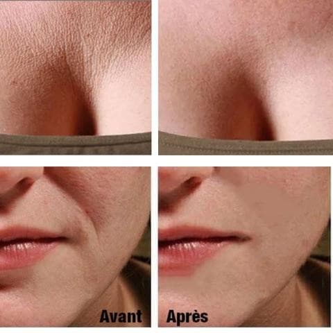Reusable anti-wrinkle patches - 16 pieces
